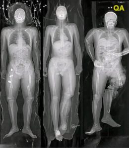 HT20. What you should know if you got the COVID vaccine: The truth behind these viral messages