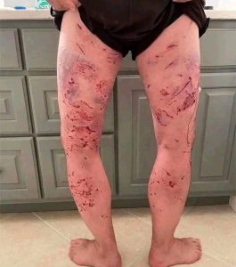 HT20. These are the consequences of sleeping with the… See more