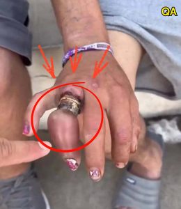 HT20. He promised never to take off his wedding ring… and ended up losi…See more