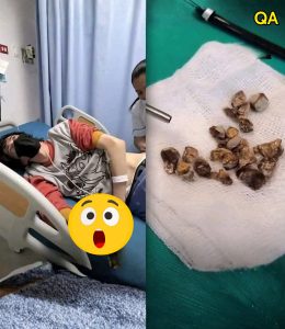 HT20. Man hospitalized after allowing himself to be pe… See more